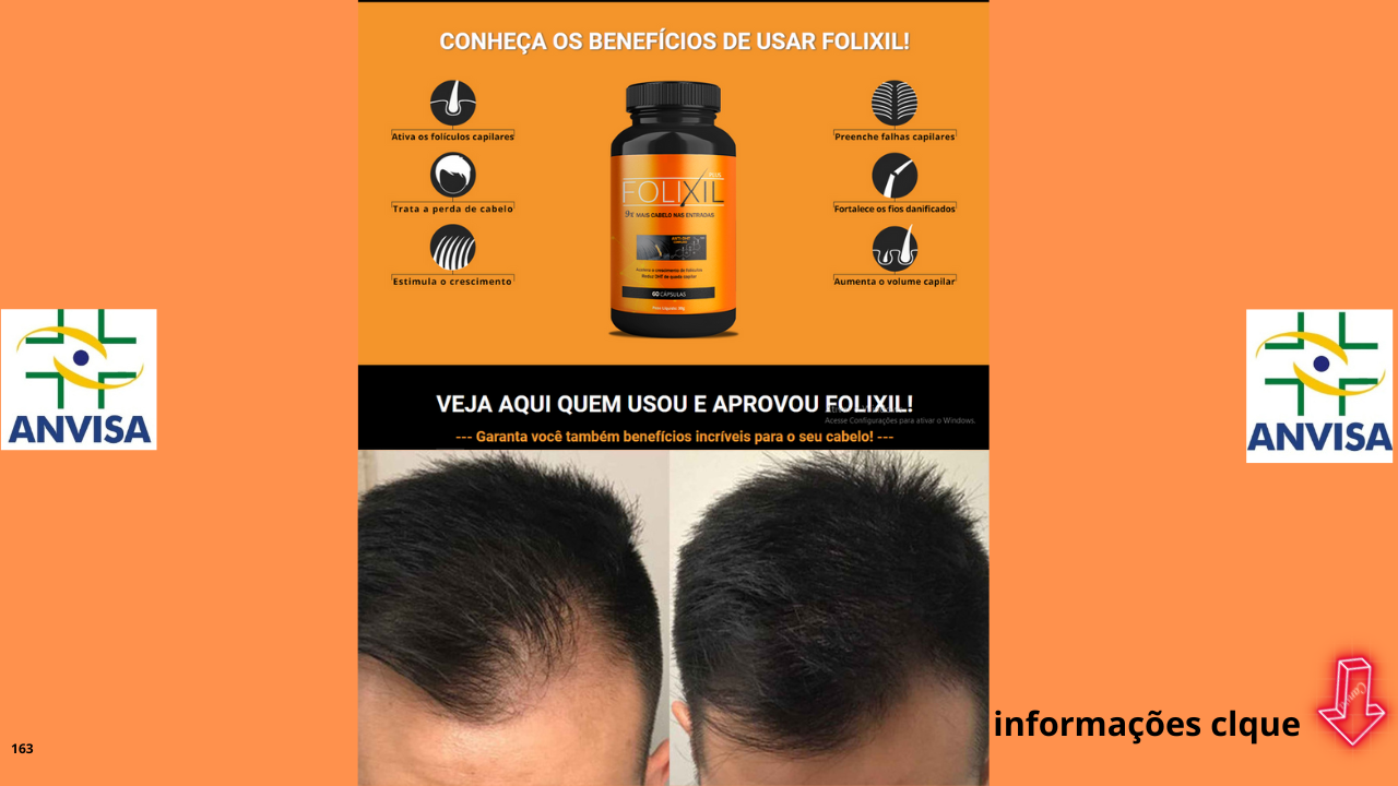 A Fórmula Plus Anti-Calvície mais usada por homens e mulheres na Europa, chegou ao Brasil! A Anvisa liberou o Folixil para brasileiros que desejam acabar de vez por todas com a calvície. O composto natural de Folixil agrega enzimas isoladas de vitaminas e fibras que agem diretamente no bloqueio do hormônio da queda capilar (DHT). Desenvolvido na República-Tcheca, Folixil ativa folículos através da liberação de espaço para crescimento capilar 9x mais forte do que cremes. Seu efeito natural, bloqueia a ação da enzima 5-alfa-redutase, que produz o DHT, isso faz com que Folixil seja capaz de preencher 75% das entradas de calvície, em poucas semanas.