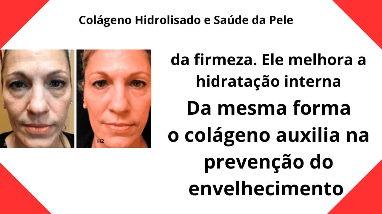 Colágeno Hidrolisado: Benefícios para a Beleza e a Pele